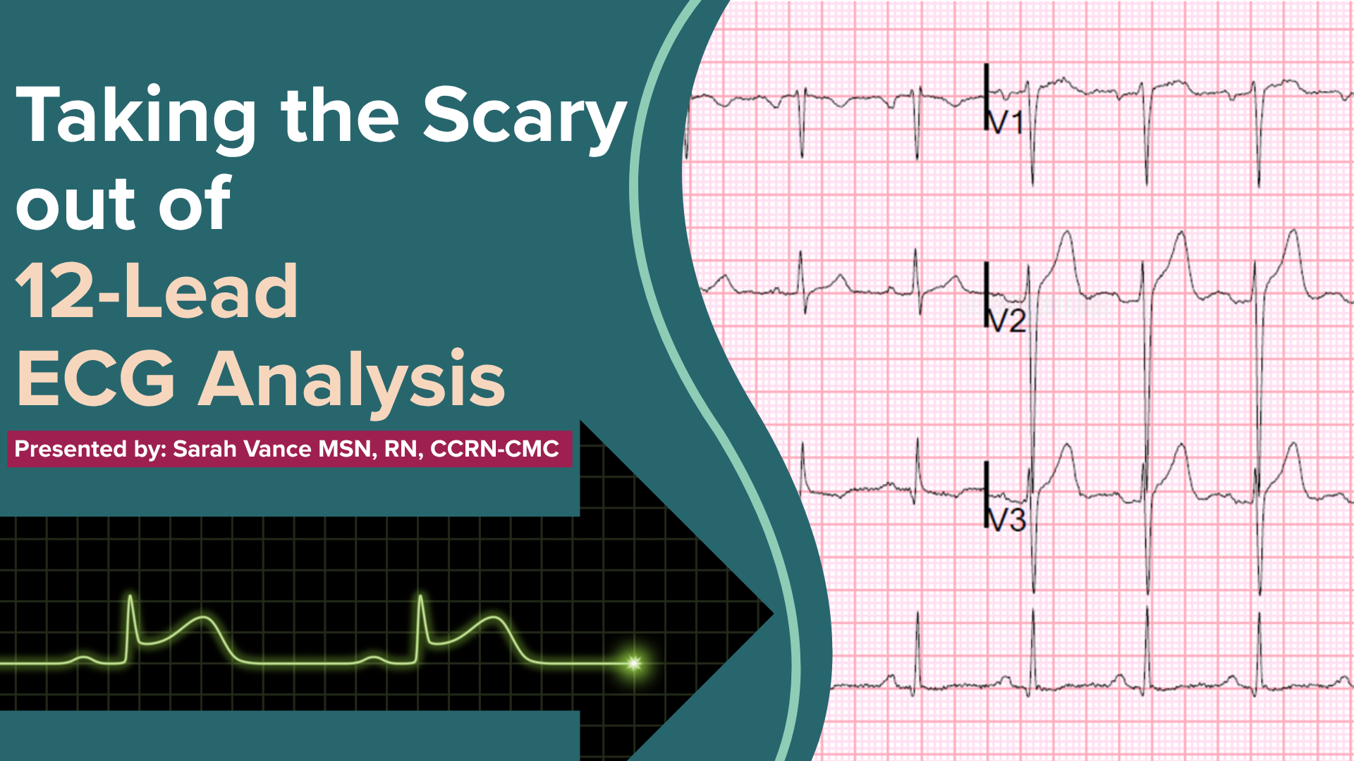 Taking the Scary Out of STEMI 12 Lead Analysis (3)